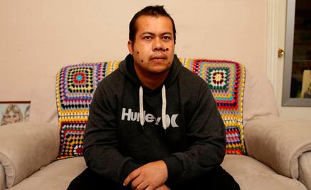 El hombre que vive con tres balas en la cabeza