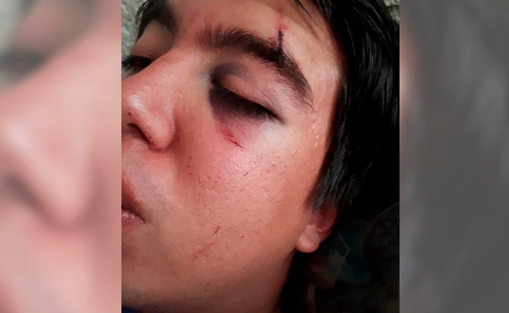 Taxistas golpean a joven por usar Uber
