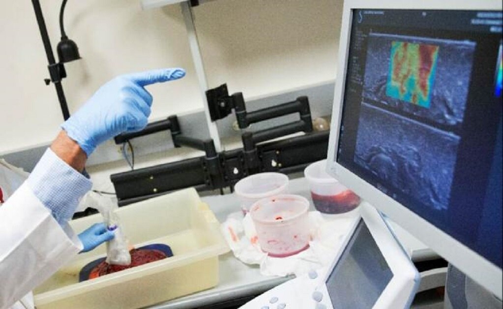 Hallan vínculo entre la placenta y desarrollo de esquizofrenia