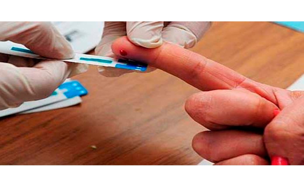 Realiza sector salud Día Internacional de la Prueba Rápida del VIH