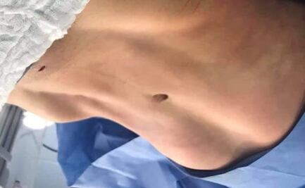 Durante 2022 clausuraron 10 establecimientos de cirugía plástica en SLP