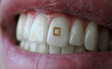 Un wearable en tu diente sabrá todo de ti