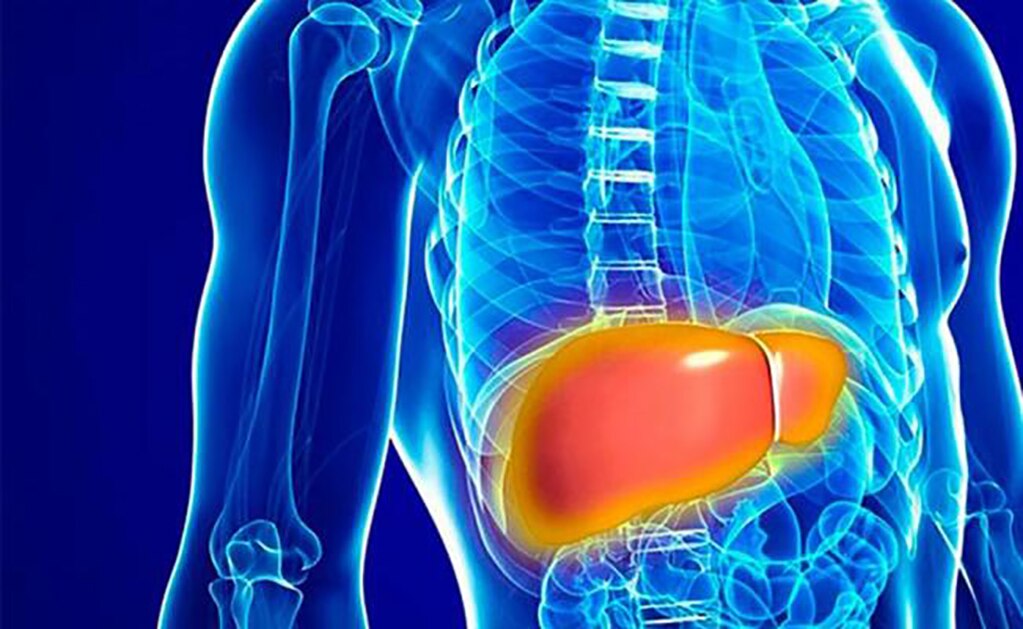 ¿Qué causas provocan el hígado graso?