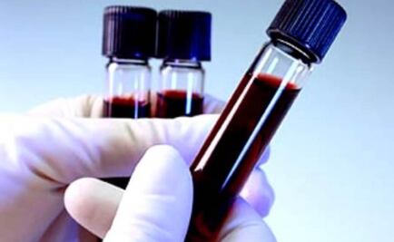 SLP registra 23 casos de niños con hemofilia