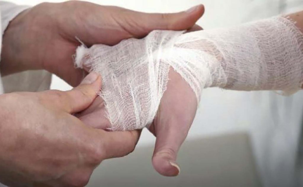 Salud reporta en SLP solo un caso de lepra en el último año