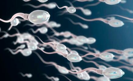 ¿Qué es el varicocele? Una de las causas más comunes de infertilidad masculina