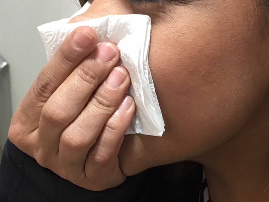 Rinitis alérgica, susceptible en época de frío