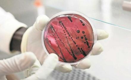 Confirman primer caso importado de viruela del mono en México