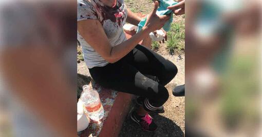 “Hecho aislado, agresión a mujer en el Parque Tangamanga"