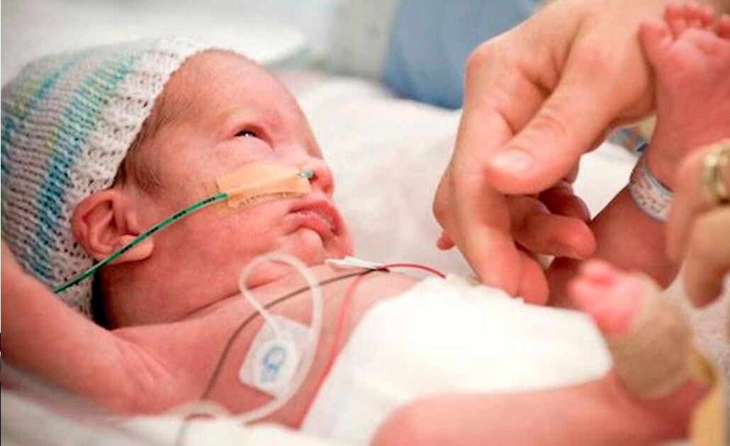 Uno de cada 10 bebés prematuros podría desarrollar ceguera