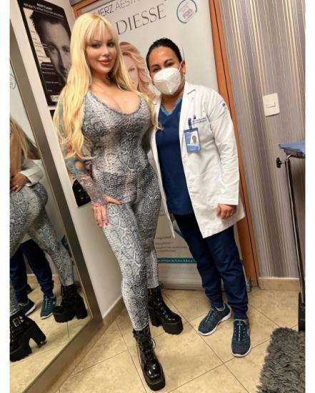 Por abusar del bótox, Sabrina Sabrok pierde parcialmente la movilidad de su rostro