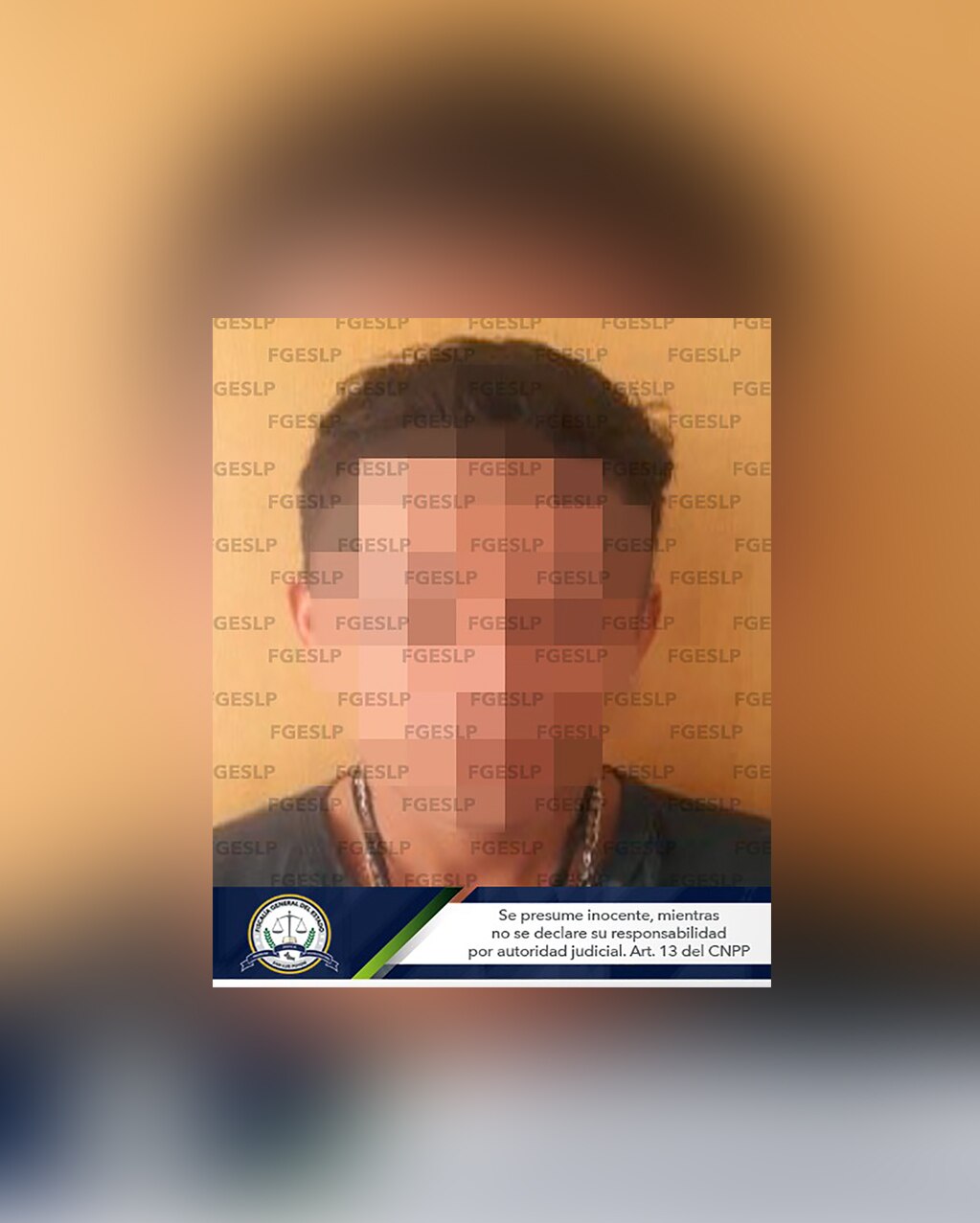 Aseguran a hombre que baleó en los riñones a su rival