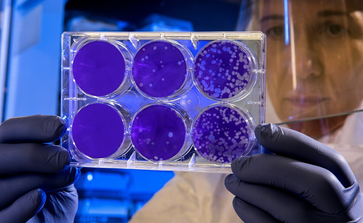 Un nivel alto de enterococcus fecalis revela las playas que no son aptas para las actividades recreativas. Foto: Unsplash.