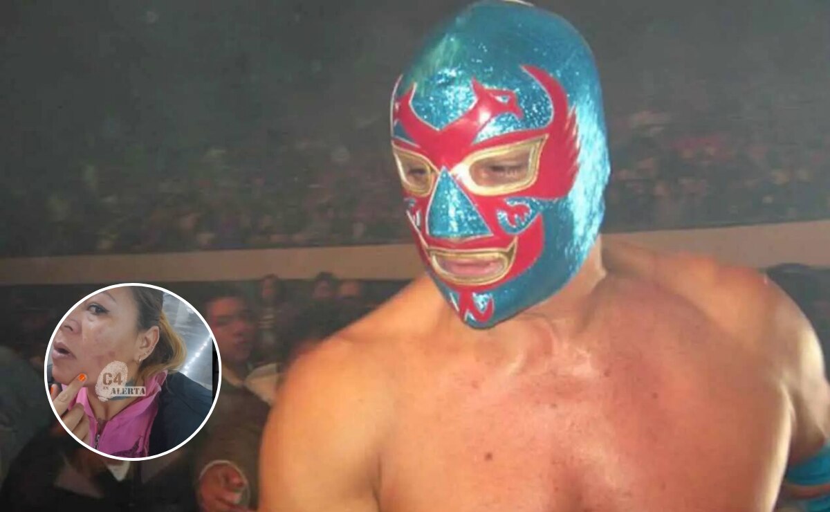 "Acusan al exluchador Dos Caras de violentar a su expareja. Diana Patricia muestra así, las lesiones". Foto: Especial