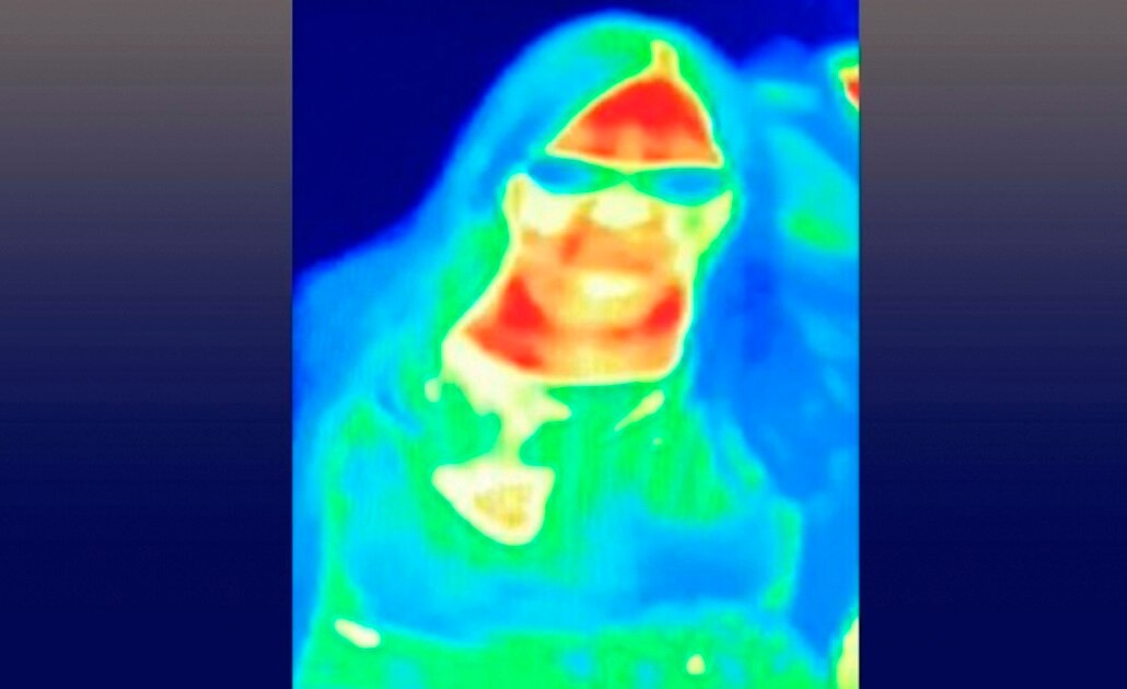 Cámara de museo de Escocia ayuda a mujer a descubrir que tenía cáncer