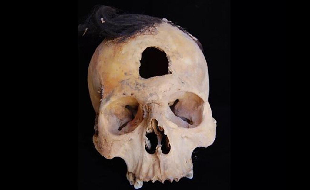 Descubren cráneos trofeo y 60 esqueletos prehispánicos en Perú