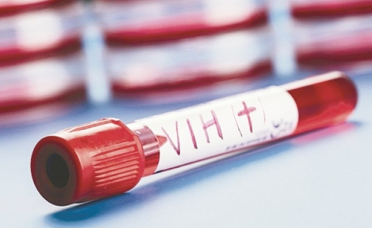  ¿Cuál es la diferencia entre el VIH y el SIDA?