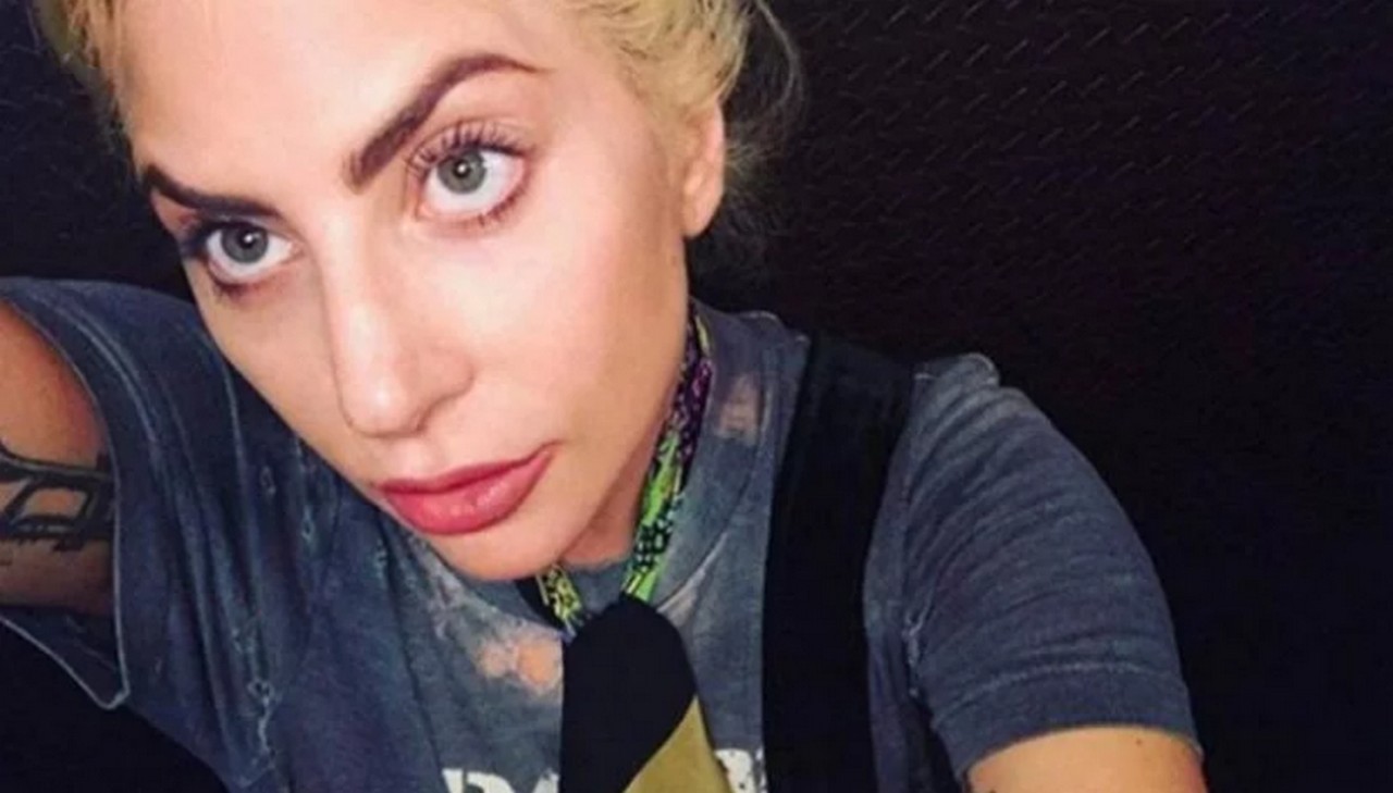  ¿Qué es la fibromialgia que padece Lady Gaga?