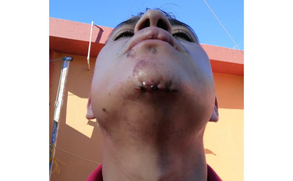 Acusan a policías municipales de Soledad de presunta agresión contra ciclista en SLP