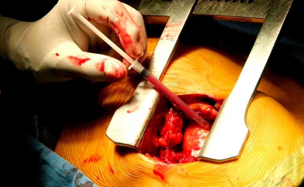 Identifican una célula que puede sanar corazones