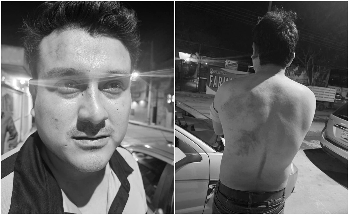 Denuncian a "Tecmol", candidato a la alcaldía de Ciudad Valles, por agresiones físicas a su promotor de campaña  