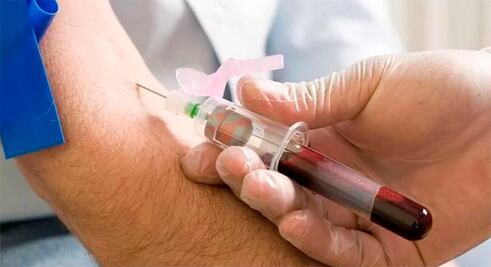 Prueba de sangre podría ayudar a detectar cáncer de páncreas