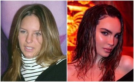 Así ha cambiado el rostro de estas famosas después de las cirugías y el bótox