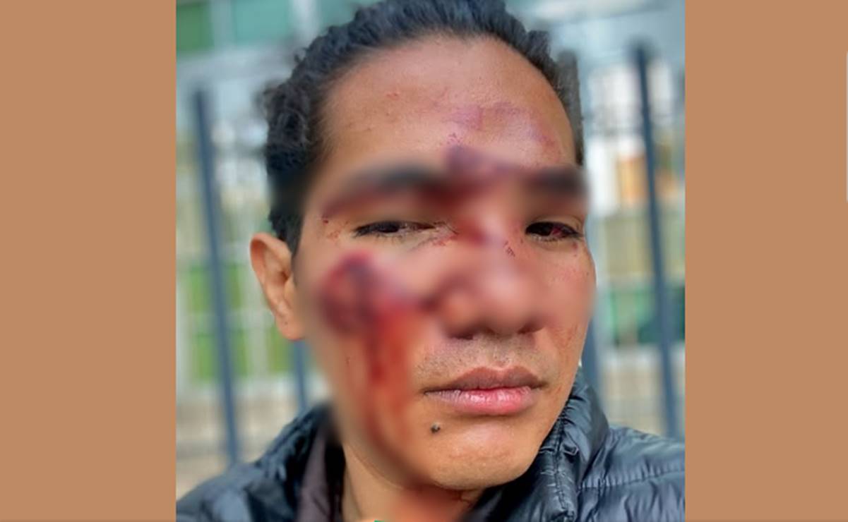 Joven acusa ser víctima de una agresión brutal por parte de seguridad del club Toxic de SLP