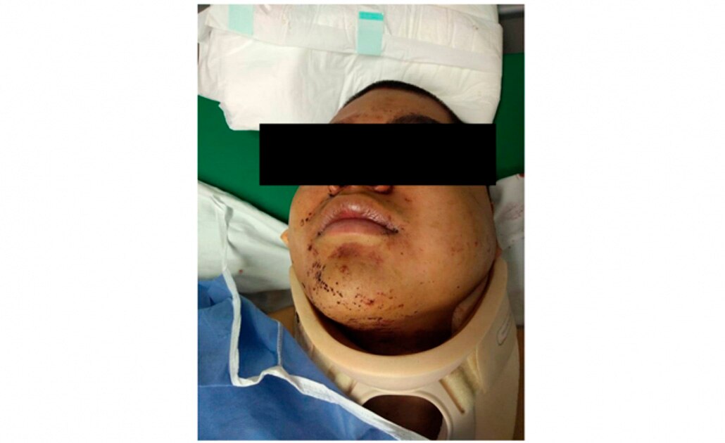 “El Titino” ordenó muerte de edil de Valle de Chalco, señalan detenidos