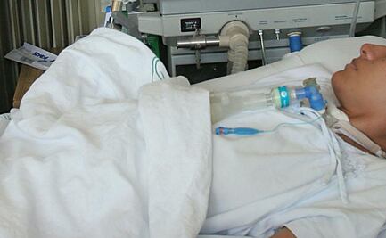 En SLP extuban a 2 menores de edad que contrajeron Covid-19; los reportan estables