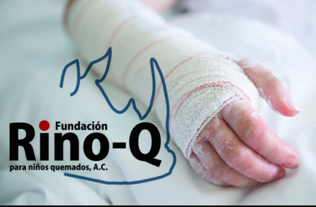 Incrementan quemaduras en menores hasta un 60% en vacaciones