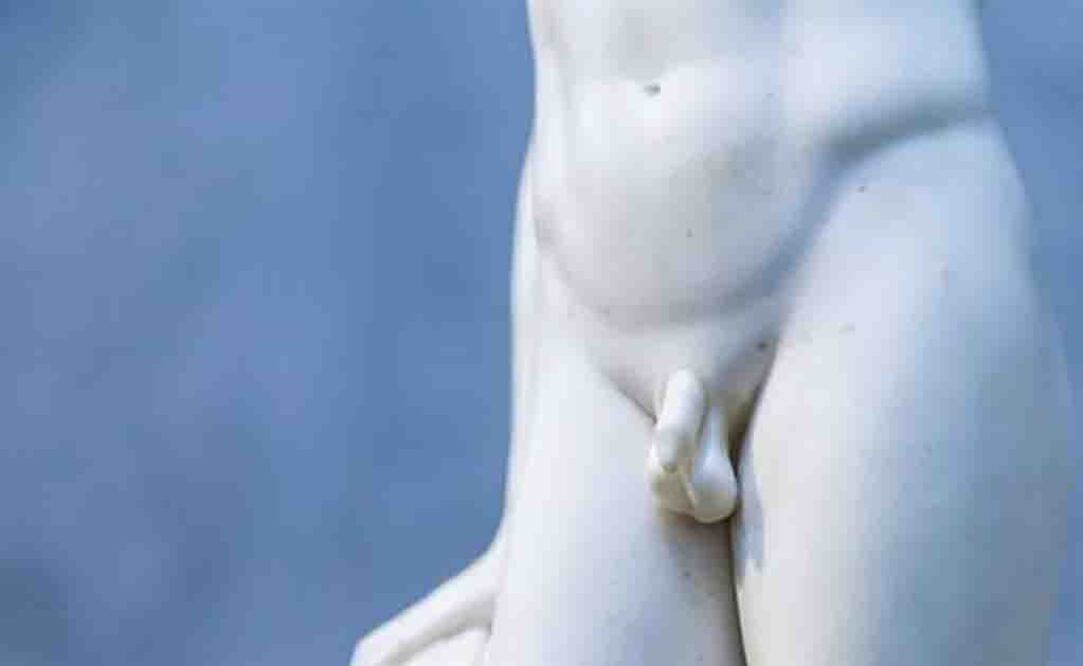 Esta fractura de pene puede producirse al aplicar una fuerza excesiva y tangencial al pene en erección. (FOTO: Especial)