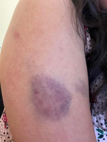 Video. Pareja denuncia brutal agresión de un conductor en SLP