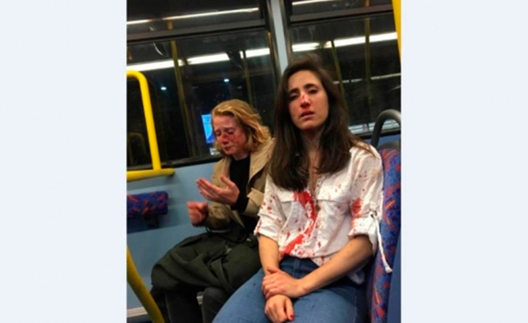 "No quisieron besarse", mujeres terminan heridas en ataque homofóbico en Londres