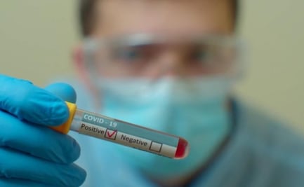 Van 49 empleados de salud muertos por Covid en San Luis Potosí