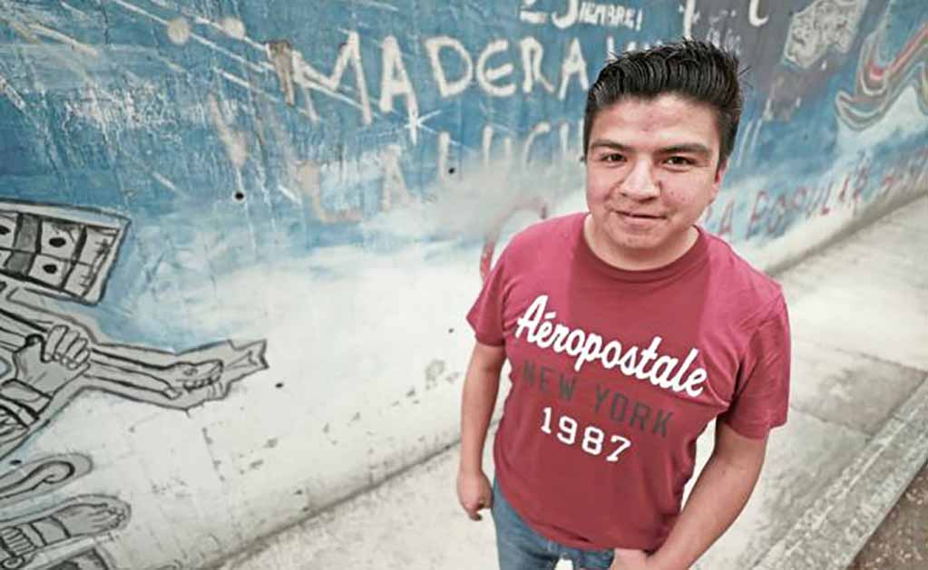 Lupus da más a mujeres que a hombres; 1% de población padece esta enfermedad