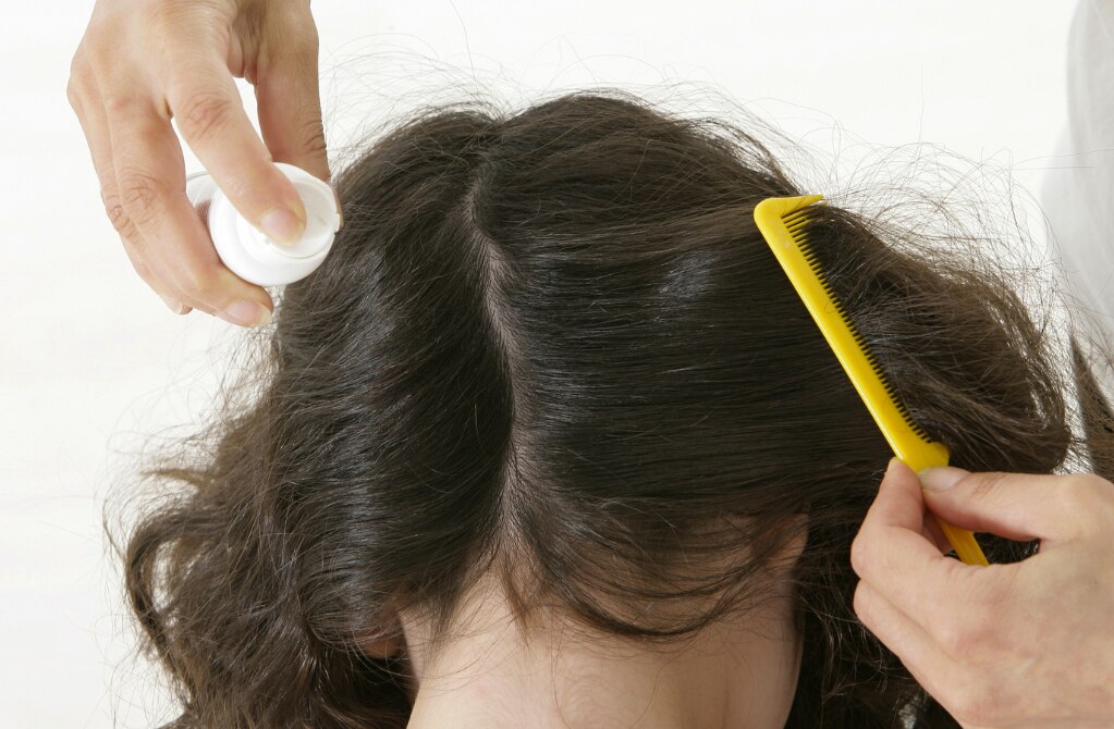 Aumenta proliferación de piojos en las escuelas