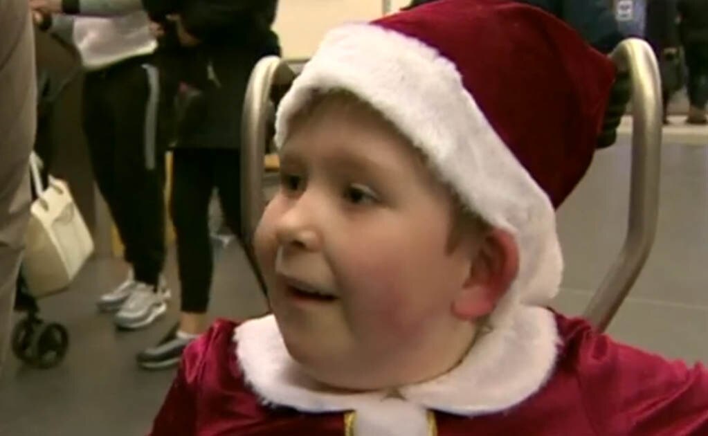 El asombroso caso del niño inglés que nació con solo el 2% del cerebro