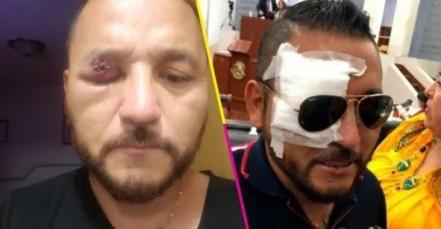 Estos son los escándalos, señalamientos y atentados que ha sufrido “El Mijis”