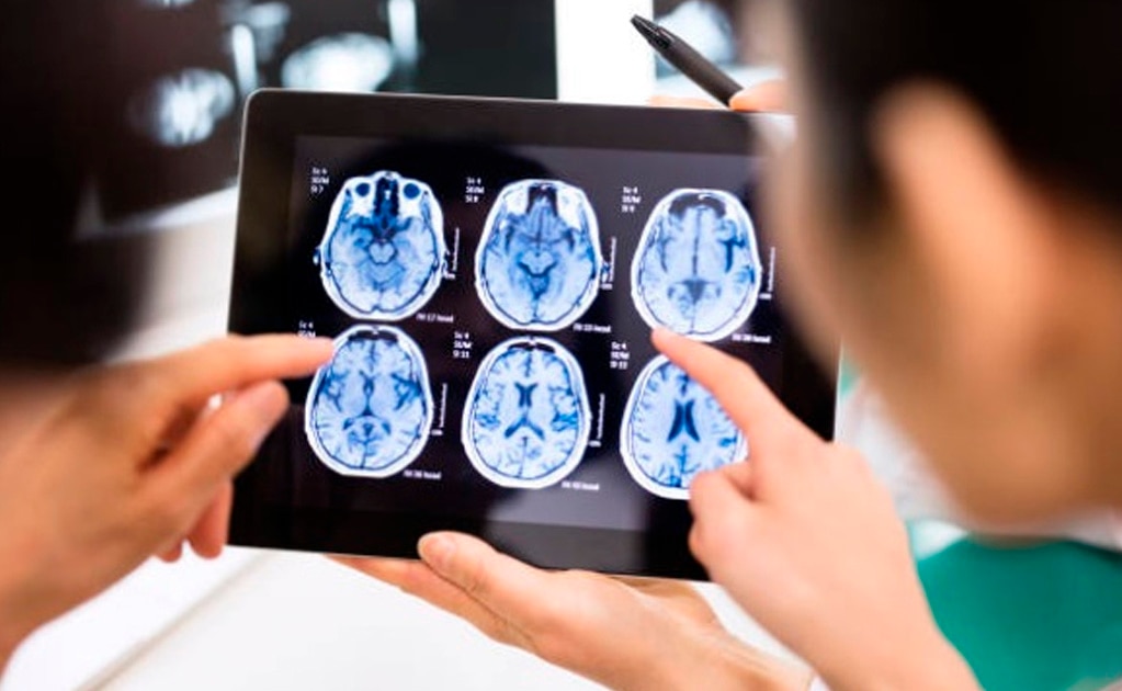 Hábitos que dañan mortalmente al cerebro