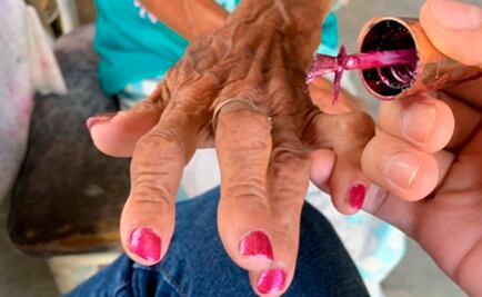 El doctor que le pinta las uñas y cocina sopa a su paciente de 83 años en Nuevo León