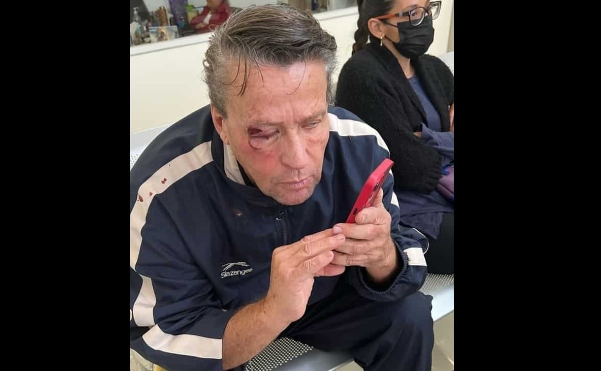 Golpean a Alfredo Adame por intentar grabar a dos personas baleadas en CDMX; hay dos detenidos