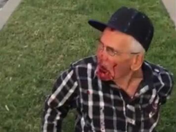 Golpean con un ladrillo a mexicano de 92 años; "vete a tu país", le exigen en EU