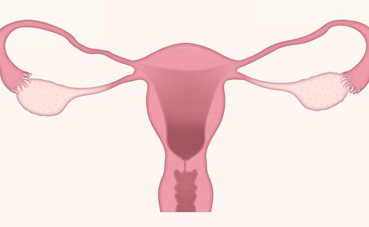 Qué es la endometrosis y cuáles son sus síntiomas. Foto: Pixabay
