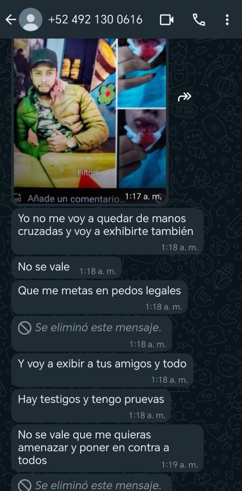 Pruebas de las agresiones de parte de la expareja de Katia Berenice