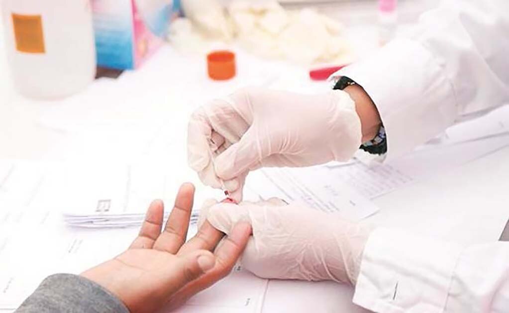 Científicos de Hong Kong hallaron la posible cura contra el VIH