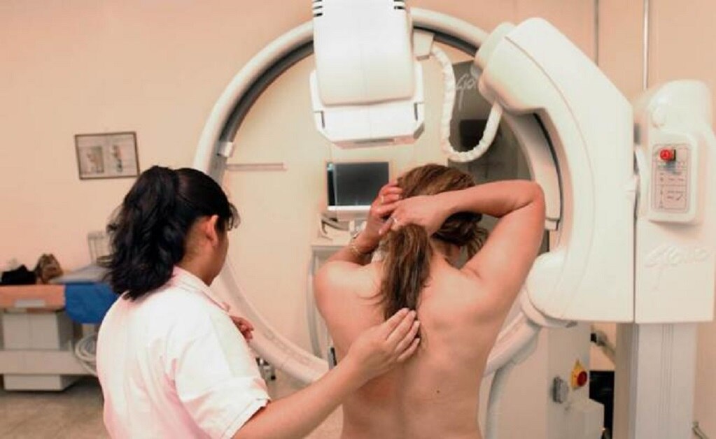 Supera IMSS los 20 mil estudios en lo que va del 2018 para detectar el cáncer de mama