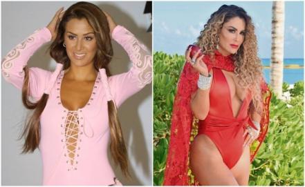 Así ha cambiado el rostro de estas famosas después de las cirugías y el bótox