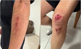 Acusan a conductor de transporte por aplicación de robo y agresión en SLP 