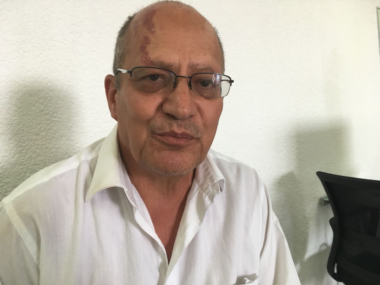 Denuncian al Hospital Central por negligencia